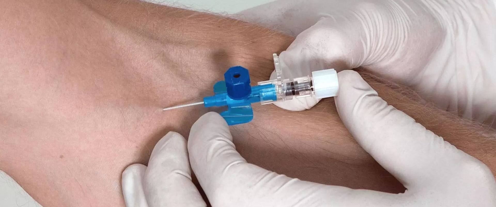 Different Methods of Administering IV Treatments