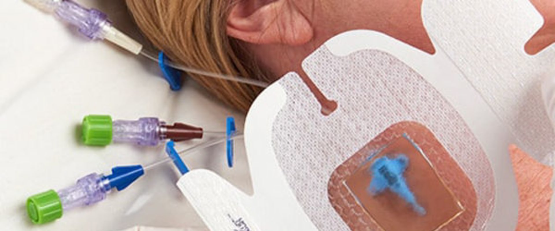 Understanding the Different Components of IV Treatment Costs