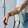 Preventing Headaches and Dizziness During IV Infusion Sessions