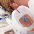 Understanding the Different Components of IV Treatment Costs