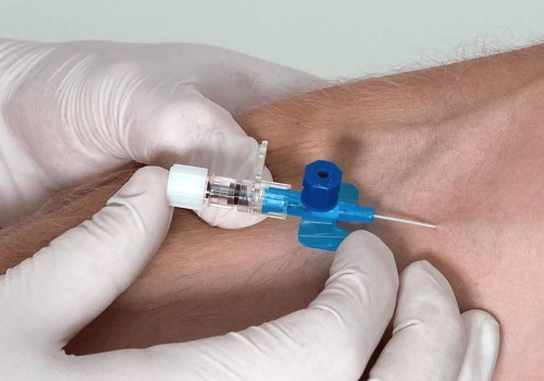 Different Methods of Administering IV Treatments