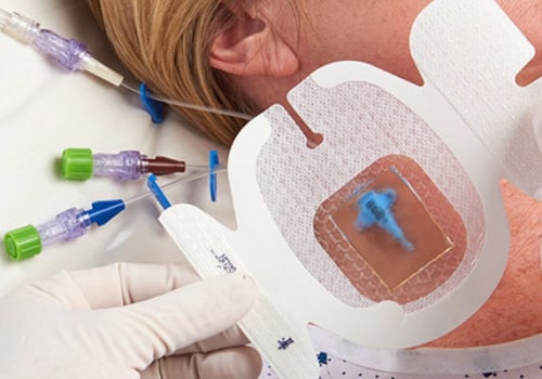 Tips for Managing the Cost of IV Therapy